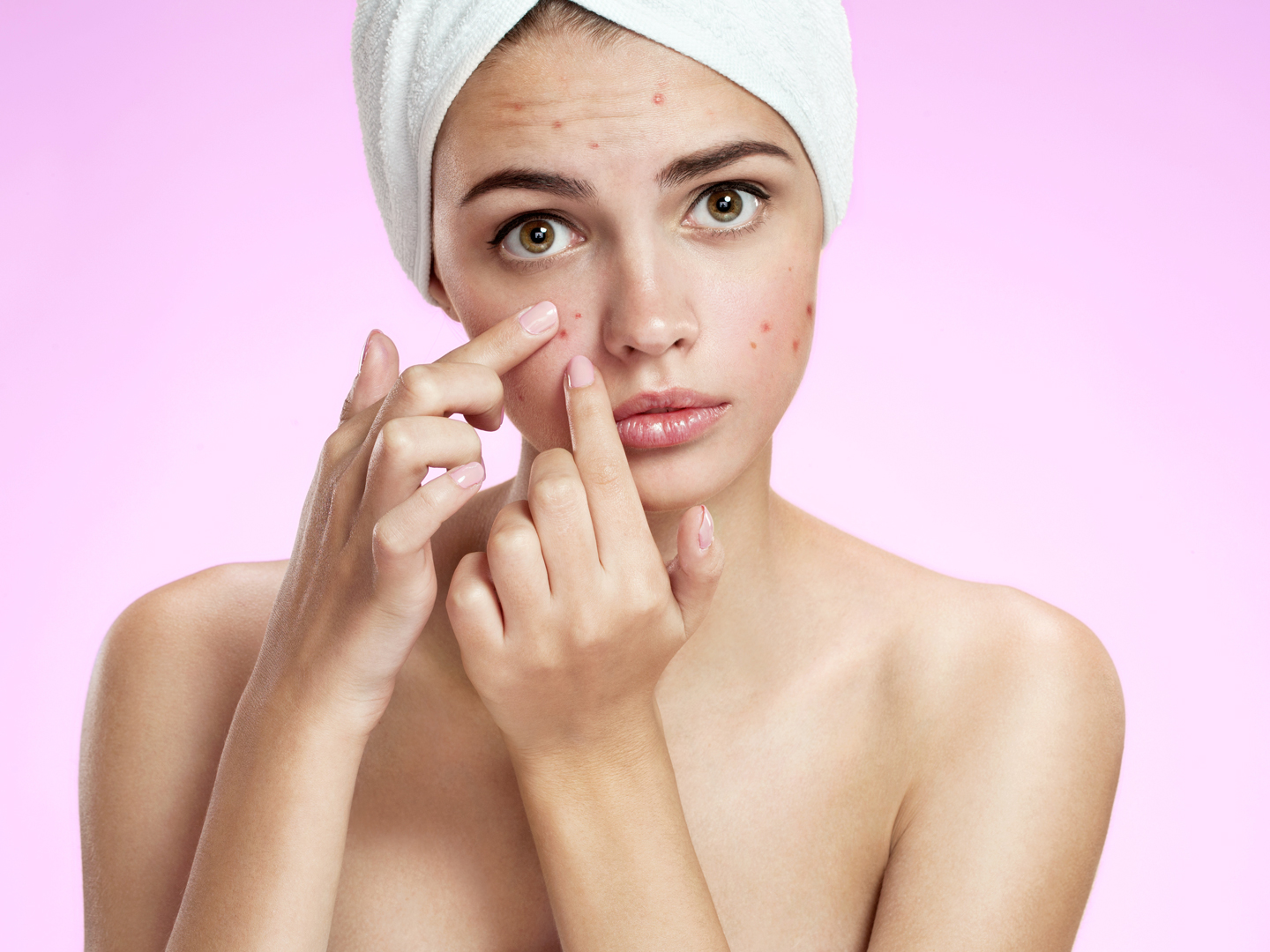 How to Use Lavender Oil for Acne