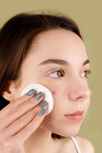 Woman with acne applying skincare with cotton pad