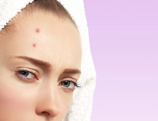 Acne. acne skincare. acne prone. skin. skin care. face. skincare. Skincare Tips. Healthy skin. Natural. Skincare Products. skincare tips. Natural Skincare. acneic skin. benzoyl peroxide. salicylic acid. retinoids
