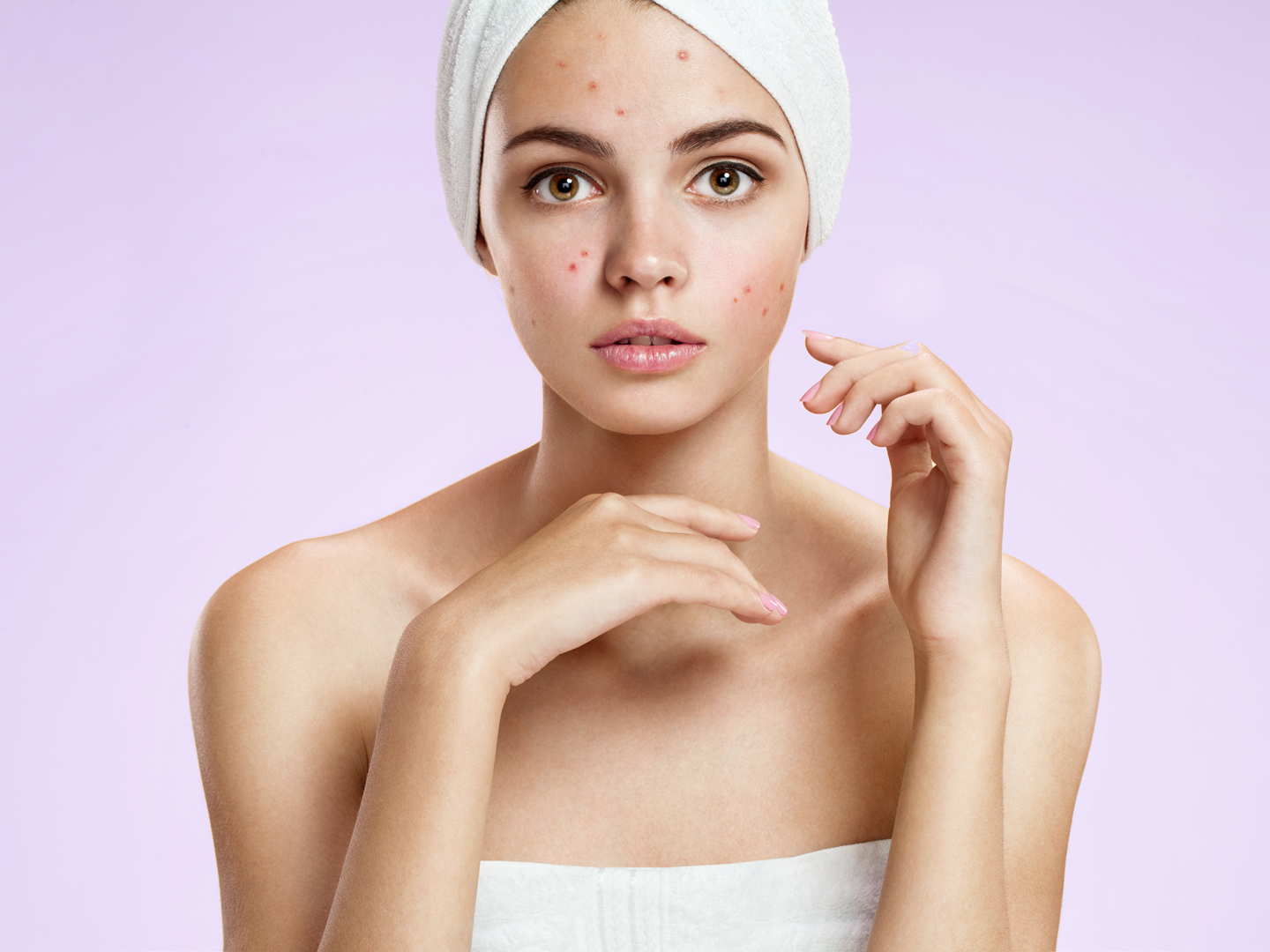 How to Reduce Pimple Redness