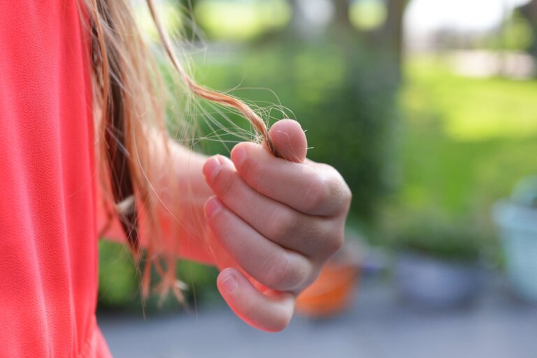 hair, hair loss