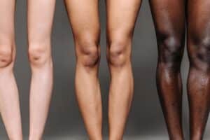 women, legs