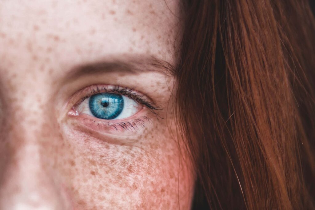 woman, Freckles
