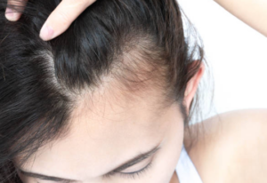 scalp, hair care